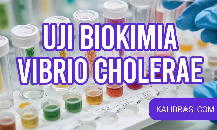 uji biokimia vibrio cholerae